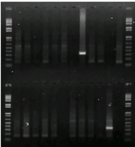 Figura 04. Fotografia da eletroforese  em gel de agarose 1%, realizada para  confirmação dos genótipos