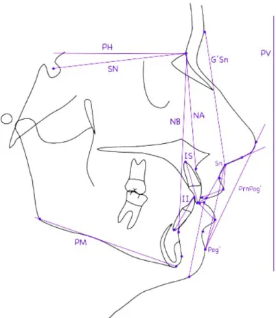 Figura 3.2: Retas traçadas para a análise cefalométrica da teleradiografia de perfil. 
