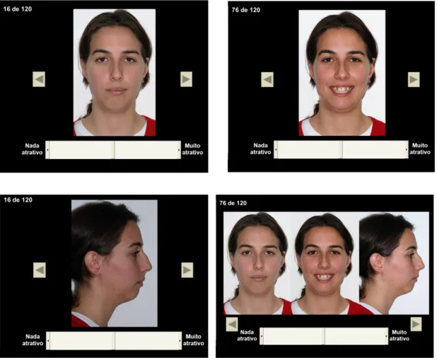 Figura  2.1:  Exemplo  de  quatro  diapositivos  visualizados  pelos  avaliadores,  com  uma  fotografia de frente em repouso, uma de frente a sorrir, uma de perfil e um tripleto