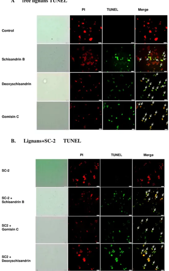 Figure 7. TUNEL assay for HepG2 cells. Cells treated with free lignans (A), and lignan plus SC-2 (B)