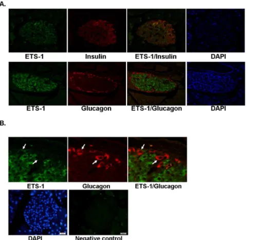 Figure 1. Ets1 is expressed in b-cells, but not in a-cells in mouse pancreas. (A). Paraffin-embedded pancreas sections from 16 weeks old mice fed chow diet were subjected to immunofluorescence analysis with rabbit Ets1 antibody together with either mouse i