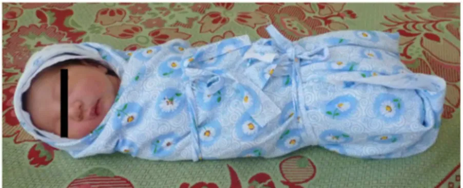 Figure 5.  Traditional swaddling in Mongolia.  The legal guardian of the subject in the photograph has given written informed consent, as outlined in the PLoS consent form, to publication of their photograph.
