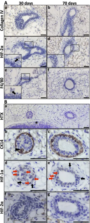 Fig 2. HIF-1 α and HIF-2 α expression in the virgin mammary gland. A. Virgin mammary glands (30 and 70 days old) showed no conspicuous basal membrane, as visualised by collagen IV IHC (a, b)