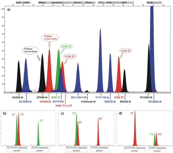 Table 6 summarizes the results of the CFTR genotypes among the five groups of infertile men in comparison to the fertile controls