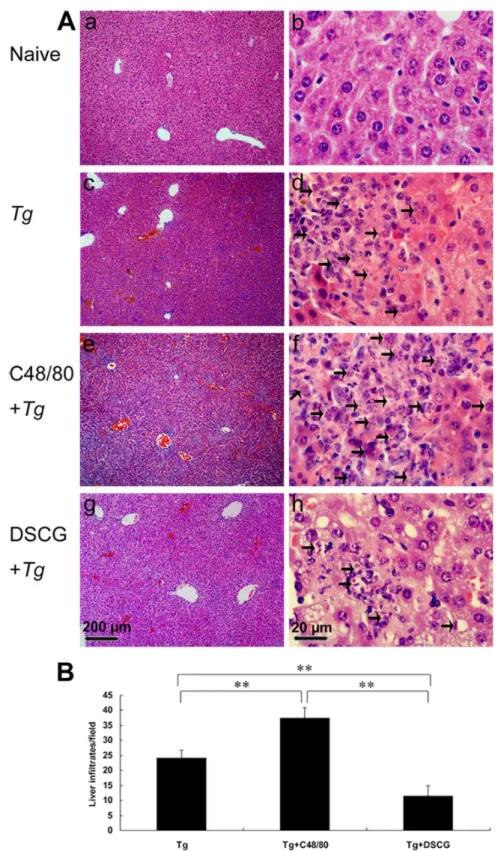 Figure 7.  The liver histological analysis of T.  gondii-infected mice from different groups.