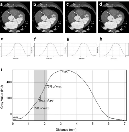 Fig 3. Analysis of contour sharpness. The DICOM images were interpolated by Vitrea fx