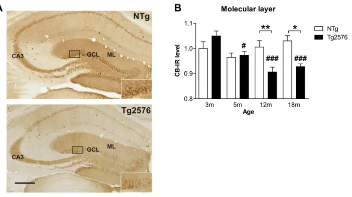 Figure 2.  Late depletion of calbindin expression in dentate gyrus of Tg2576 mice.  (A) Brain sections of 1β month-old NTg and Tgβ576 mice immunolabeled for calbindin (CB)