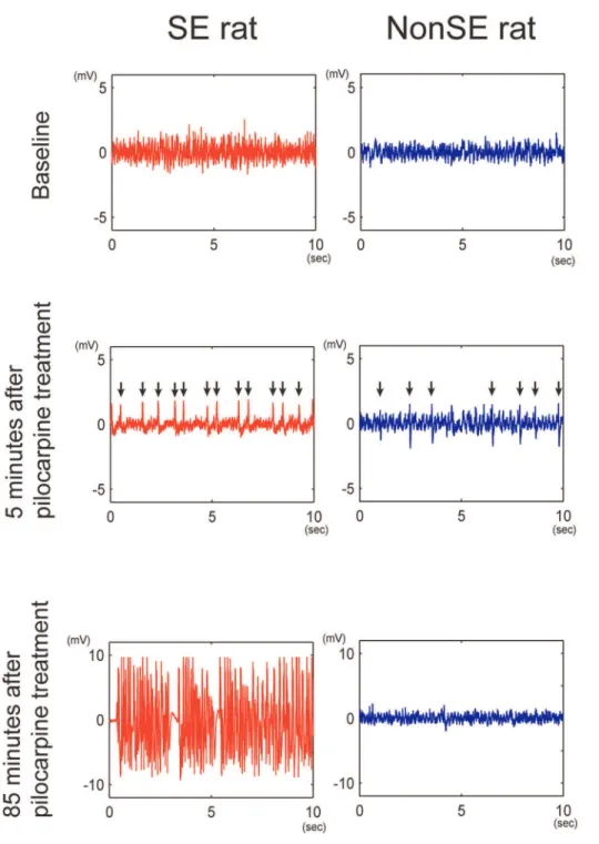 Figure 3. Local field potentials in 10-sec time windows of representative SE and nonSE rats at baseline period (upper panel) and at 5 min (middle panel) and 85 min (lower panel) after pilocarpine treatment.