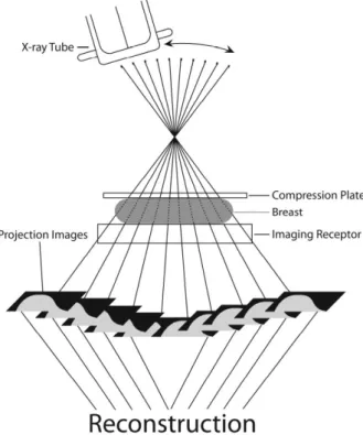 Figure 2.7: Schematic view of digital breast tomosynthesis. (Duplicated from [30])