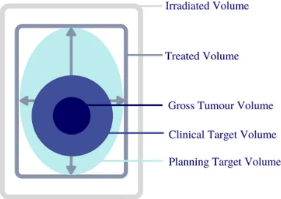 Figure 2: Definition of target volume. Target volume includes real tumour volume (gross tumour volume), real and suspect tumour volumes (clinical target volume), the margin for variations in tumour size or position (planning target volume), the volume whic