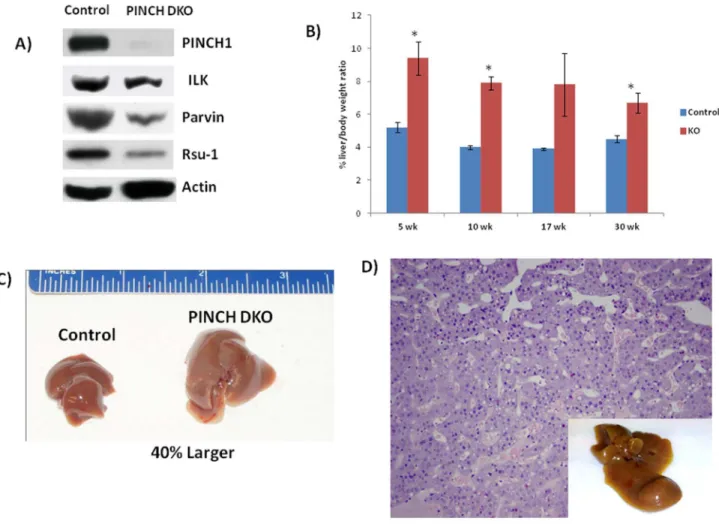 Figure  2.    Morphological  changes  in  PINCH  DKO  mice.    A)  Hepatocytes  isolated  from  PINCH  DKO  mice  show  absence  of PINCH1  (Note:  PINCH2  is  already  systemically  removed)