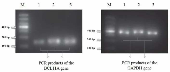 Figure 2. Agarose gel electrophoresis of the amplified PCR product.