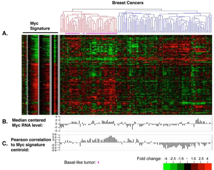 Figure 5. The MYC gene expression signature in breast tumor tissue. A. The Core MYC signature gene list was extracted from a breast cancer profiling dataset containing 105 tumor samples, 9 normal breast samples, and 26 sample pairs [37]