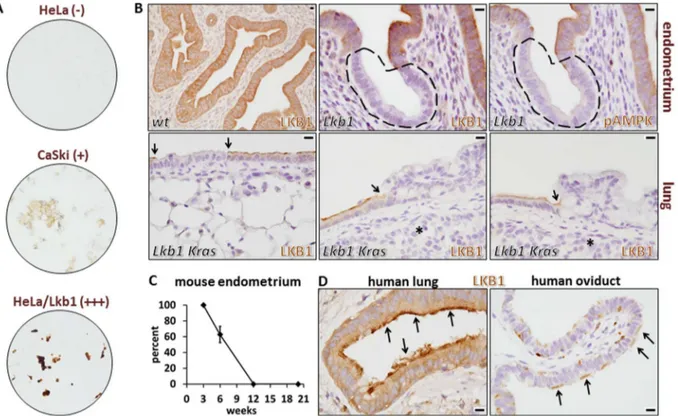 Figure 1. Validation of LKB1 rabbit monoclonal antibody D60C5 for immunohistochemistry in human and mouse paraffin- paraffin-embedded, formalin-fixed samples