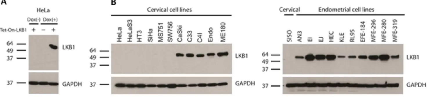 Figure 3. Validation of rabbit monoclonal antibody D60C5 by Western blotting. Positions of molecular weight standards (kilodaltons) are shown to the left of each blot