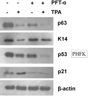 Figure 5. PFT- a reversed TPA-induced K14 down-regulation in PHFK cells. PHFK cells were treated with PFT-a or DMSO and then were treated with TPA or DMSO