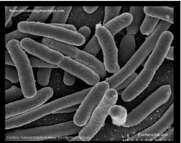 Figura 5: E. coli (62) 
