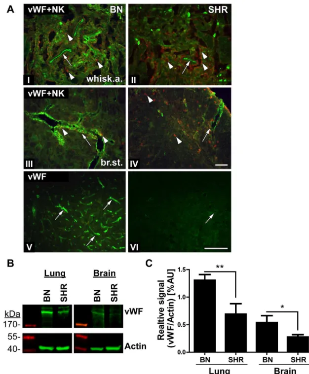 Fig 6. Less expression of vWF in the brain of SHR rats. (A) Transversal/coronal sections from the whiskers area (I and II) and the brain stem (III–VI) of BN (I, III and V) and SHR (II, IV and VI) rats at 4dpi, stained with vWF Ab (green) (I–VI), NK cell ma