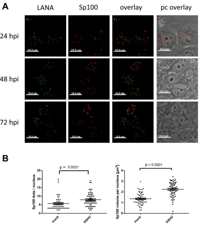 Figure 6. LANA does not co-localize with Sp100, and KSHV infection does not disperse Sp100 from ND10s