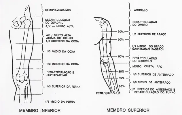 Figura 1: Classificação da amputação do membro inferior e superior, segundo Adams  et al