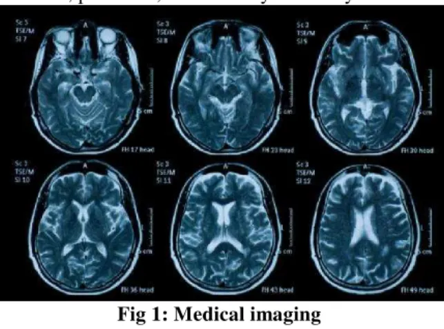 Fig 1: Medical imaging 