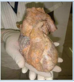 Fig. 1: Gift your body to help future generations 