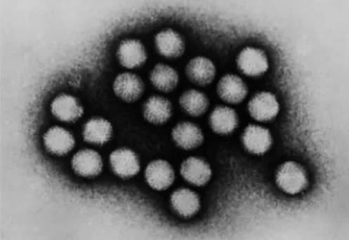 Figura 3: Foto de microscopia electrónica de adenovírus caninos  