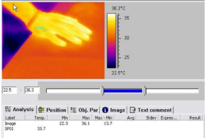 Figure 2. Termographic data. 
