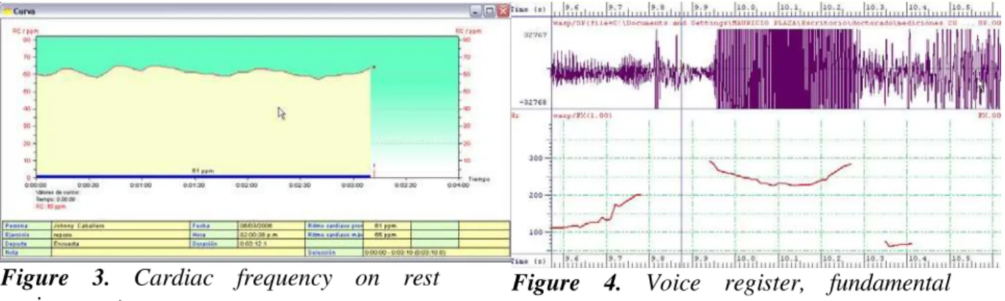 Figure 3. Cardiac frequency on rest  environment. 