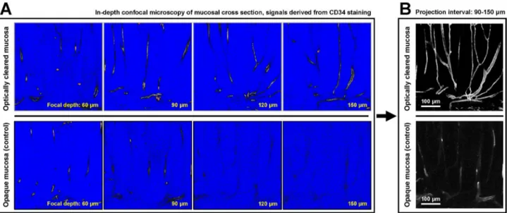 Figure  2.    Deep-tissue  microscopy  of  microvessels  in  normal  colon  mucosa.    (A)  Extended  imaging  depth  in  confocal microscopy with optical clearing