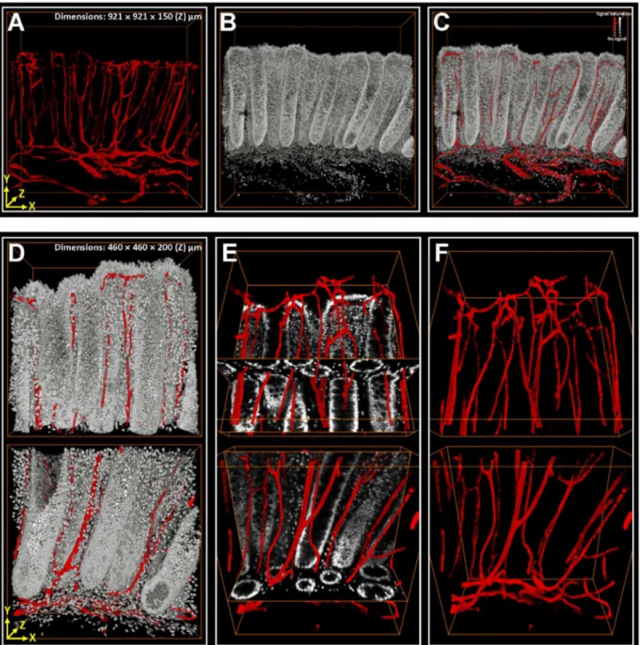 Figure 3.  3-D image rendering and projection of colonic microstructure and vasculature