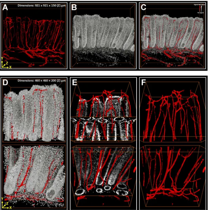 Figure 3.  3-D image rendering and projection of colonic microstructure and vasculature