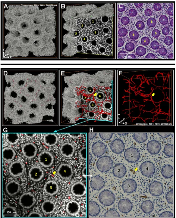 Figure 4.  Matched tissue information derived from 3-D and 2-D histology.  (A-C) Matched crypt morphology in micrographs derived  from  3-D  microscopy  and  H&amp;E  staining