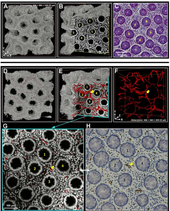 Figure 4.  Matched tissue information derived from 3-D and 2-D histology.  (A-C) Matched crypt morphology in micrographs derived  from  3-D  microscopy  and  H&amp;E  staining