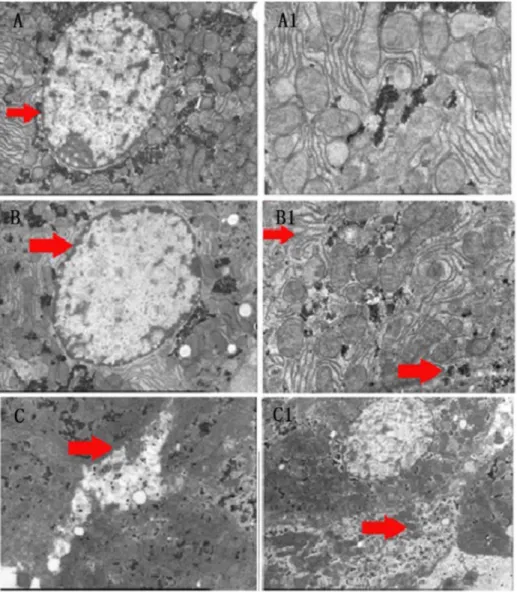 Fig. 3. Electron microscope images of rat liver cell changes. Control group: (A) large and round nucleus in the center with smooth nuclear membrane (arrow), visible nucleolus and rich in shallow euchromatin