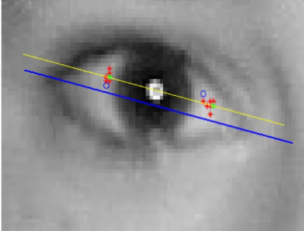 Figura 8 – Imagem representativa da obtenção iterativa do ângulo de inclinação do olho  representado na imagem