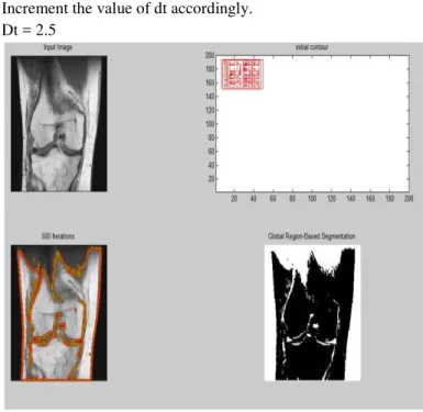 Figure 1: Distance Mask Of initial Mask 