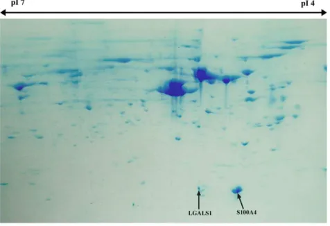 Figure 2. Two dimensional electrophoresis gel for AP cells. The gel highlights the strong expression of S100A4 and LGALS1 proteins in AP cells