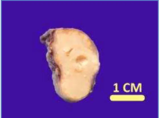 Fig. 1: Gross appearance 