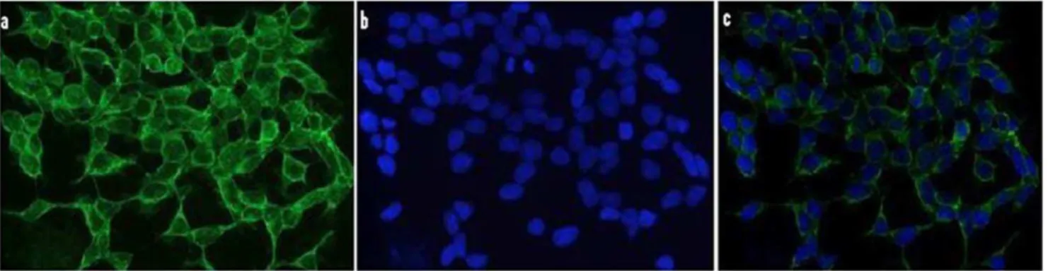 Figure 1. Immunocytochemical localization of 5-LO in N2A-APPswe cells. Cells were plated on glass cover slips, fixed in 4%