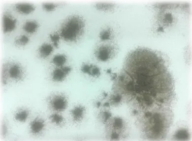 Figura 1.4 – Aspecto de fungo Penicillium expansum responsável pela Podridão azul, em  PDA  (foto da autora).