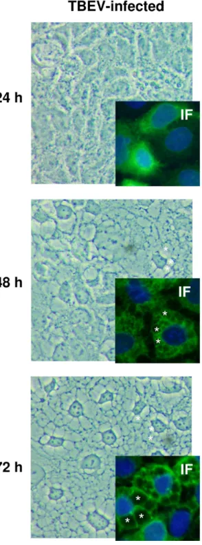Figure 2. Vacuolization induced by TBEV infection. Caco-2 cells were infected with TBEV K23 virus