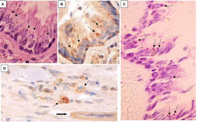 Figure 1. Light microscopic studies of tissues from KD patient 1. A, H&amp;E of ciliated bronchial epithelium, demonstrating amphophilic supranuclear ICI (arrows); B, IHC using synthetic antibody J of ciliated bronchial epithelium, showing ICI (arrows); C,