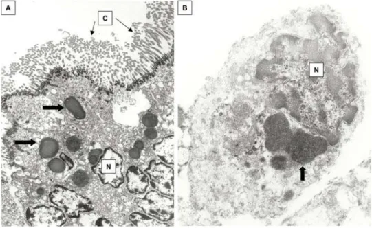 Figure 5. Transmission electron microscopy (TEM) of ciliated bronchial epithelium from glutaraldehyde-fixed, previously frozen lung from KD patient 3
