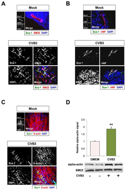 Figure 4. CVB3 induced premature differentiation of cardiac progenitor cells. Three day-old mice were infected with eGFP-CVB3 (10 5 pfu IP) or mock-infected, and hearts were isolated at 2 days PI