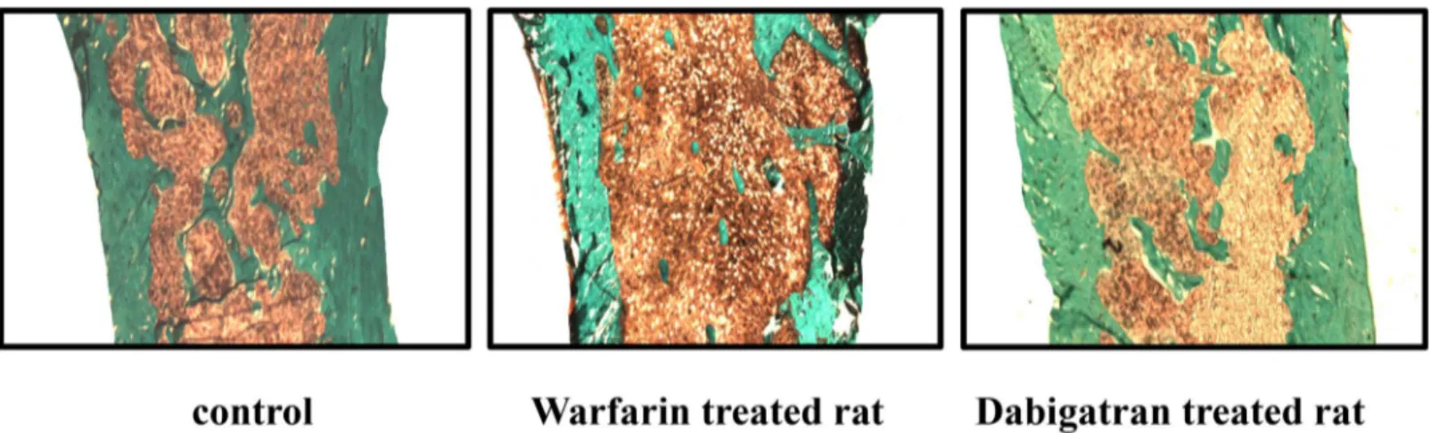 Fig 2. Dabigatran preserves femur volume and structure. Note the higher bone volume and trabecular thickness with lesser trabecular separation in rats treated with dabigatran compared to rats treated with warfarin