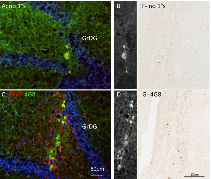 Figure 9A shows plaques in the neocortex (temporal lobe) of an AD case, labelled with the 4G8 antibody