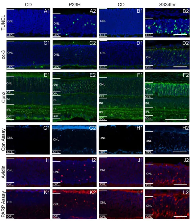 Figure 2. Differential regulation of cell death markers in (1) wt and (2) rhodopsin transgenic rats