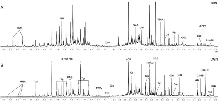 Figure 2. OPLS-DA scores plot of urine 1H NMR spectra of healthy controls and patients with FSGS, IgAN, MN and MCD.