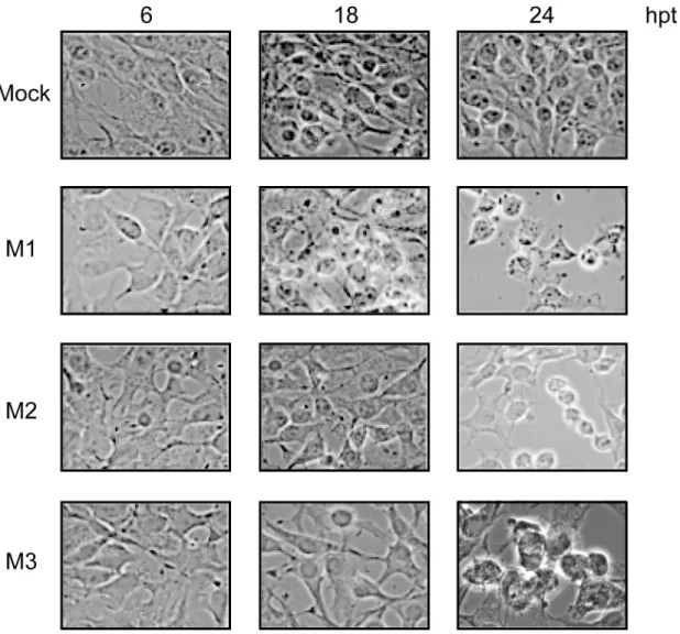 Fig 2. Cytotoxic effect mediated by expression of VSV M proteins. BHK-T7 cells were transfected with pTM1 empty (mock), pTM1-M1, pTM1-M2 or pTM1-M3 for 2 h